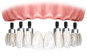 Ilpo-Laboratório de Prótese Odontológica - Foto 1